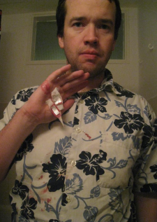 Pete with a bloody Hawaiian shirt and a bloody bandaged hand